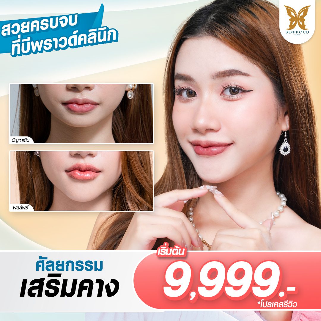 โปรโมชั่น_เสริมคาง โปรโมชั่น_เสริมคาง