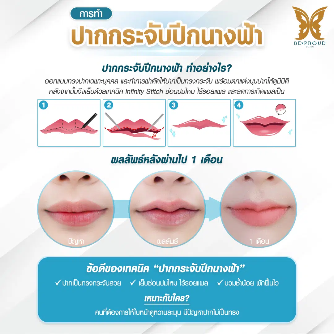 ปากกระจับ ปากกระจับ