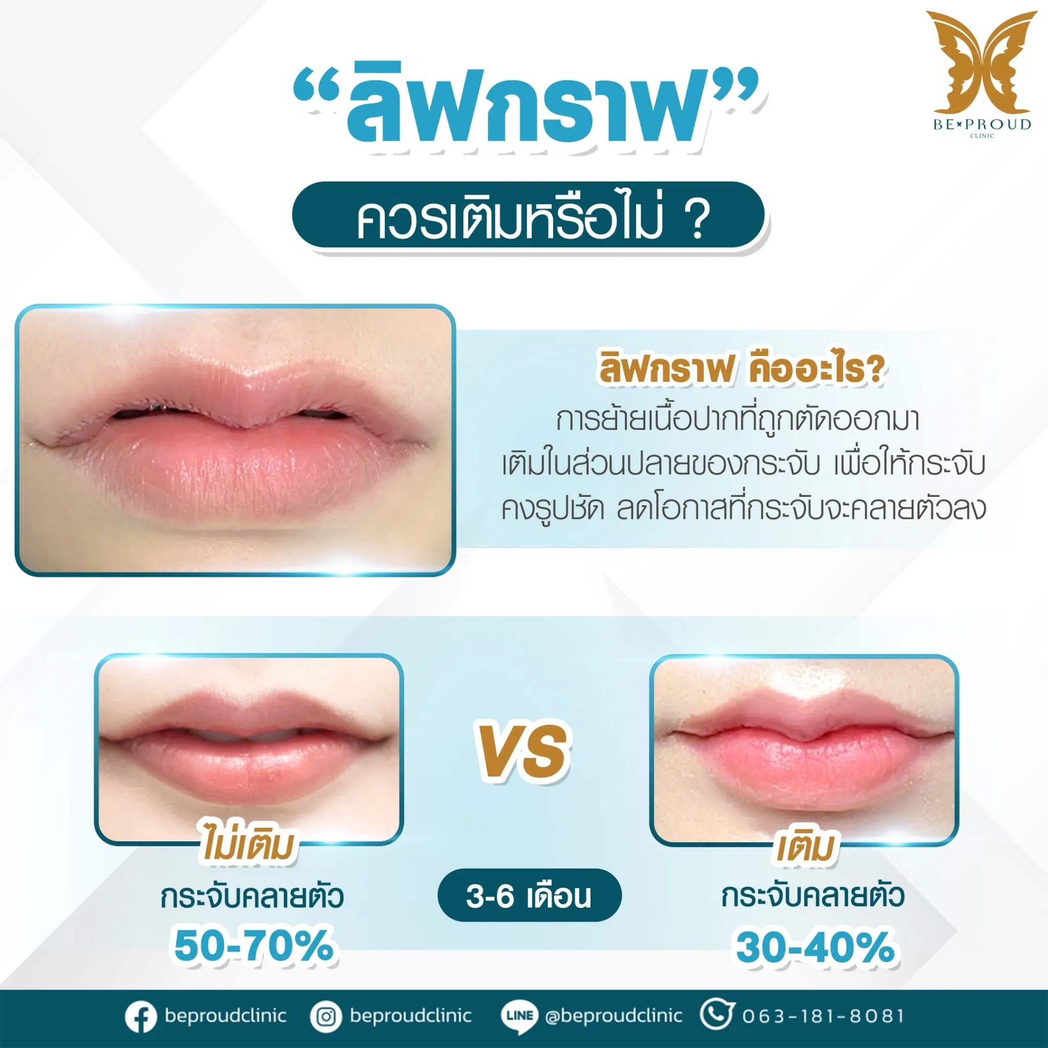 ลิปกราฟคืออะไร ลิปกราฟคืออะไร