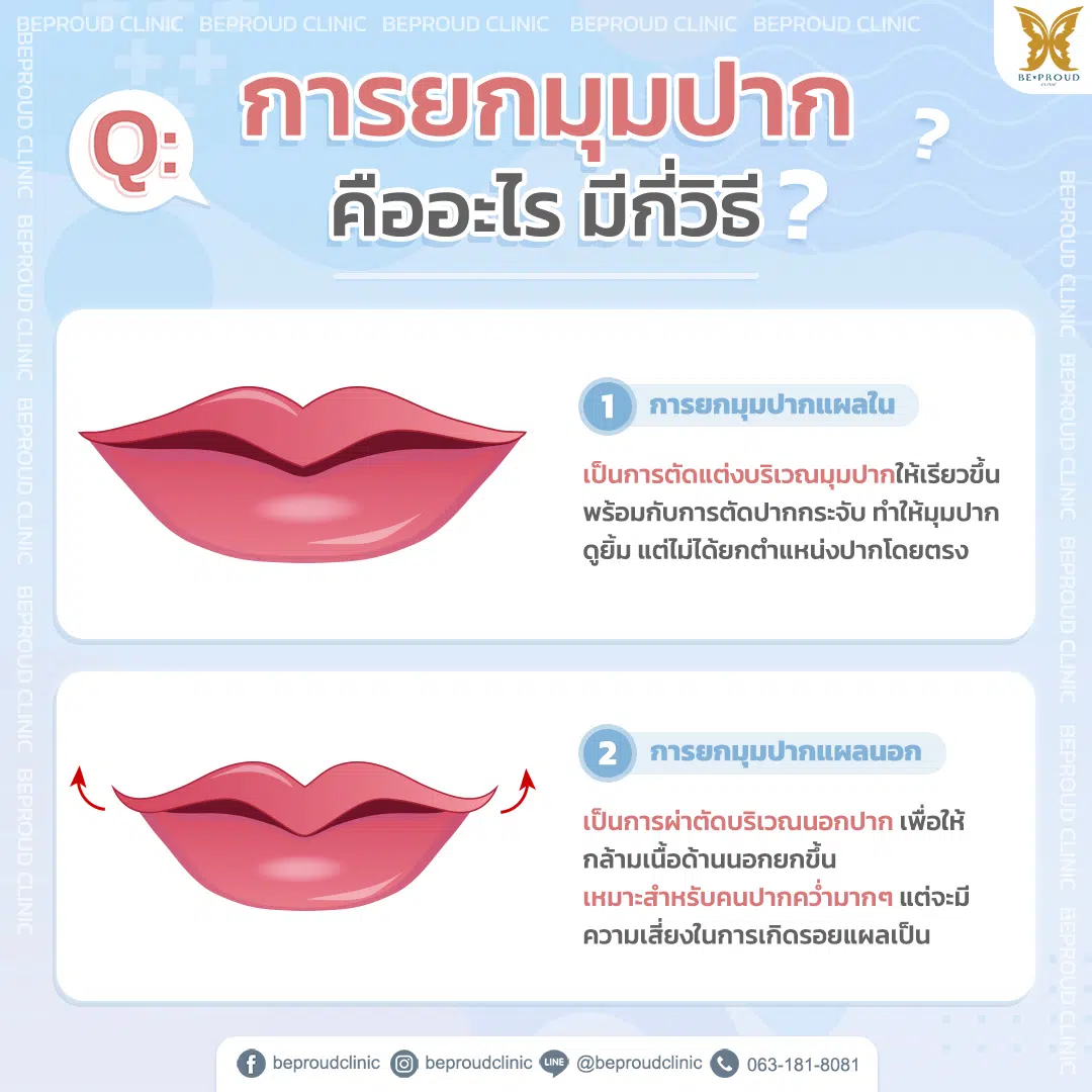 การยกมุมปากมีกี่วิธี การยกมุมปากมีกี่วิธี