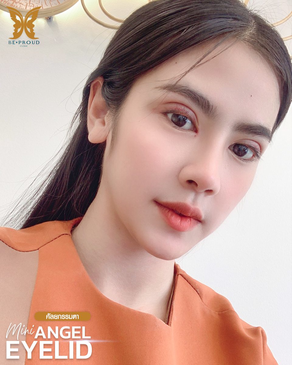 ตาสองชั้น_รีวิวจากลูกค้า(8) ตาสองชั้น_รีวิวจากลูกค้า(8)