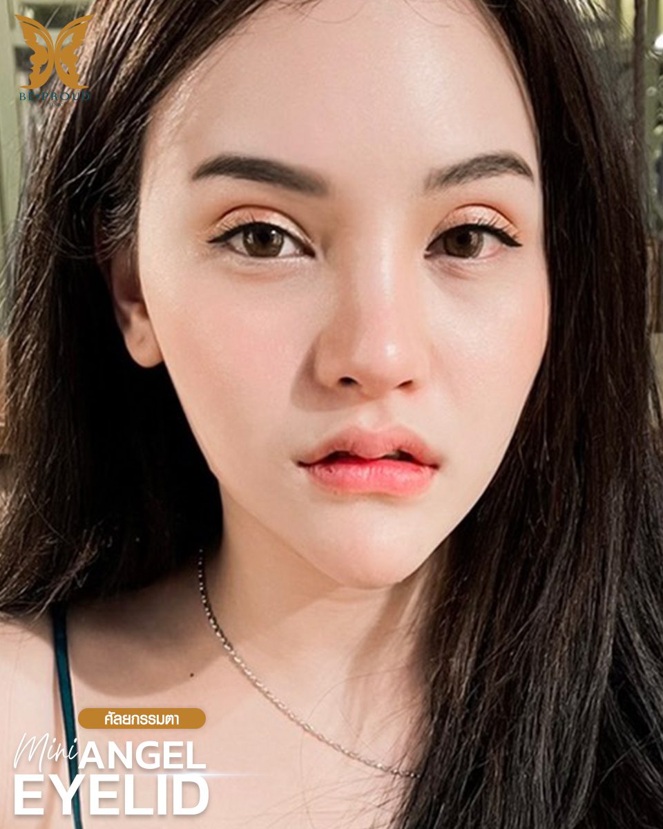 ตาสองชั้น_รีวิวจากลูกค้า(2) ตาสองชั้น_รีวิวจากลูกค้า(2)
