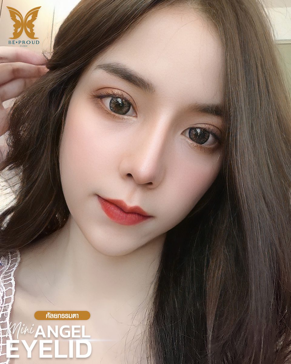 ทำตาสองชั้น รีวิวจากลูกค้า(3) ทำตาสองชั้น รีวิวจากลูกค้า(3)
