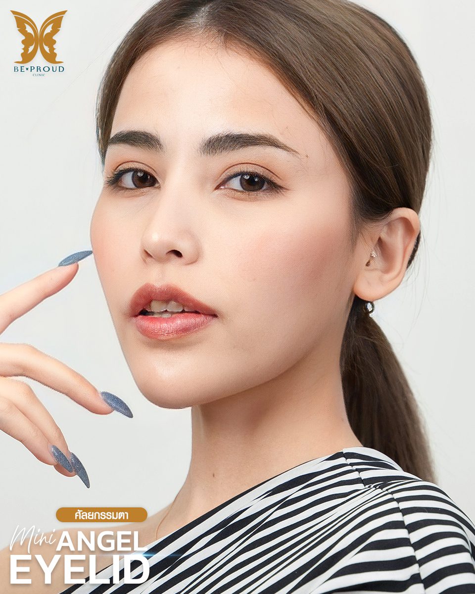 ตาสองชั้น_รีวิวจากลูกค้า(5) ตาสองชั้น_รีวิวจากลูกค้า(5)