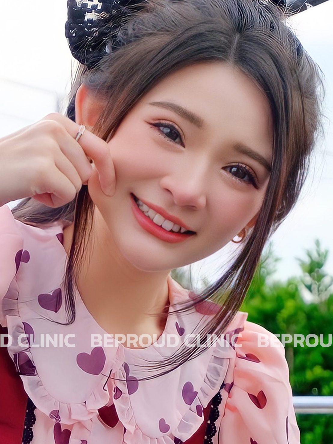 ตาสองชั้น_ตาสองชั้นเกาหลี(1) ทำตาสองชั้น _ตาสองชั้นเกาหลี(1)