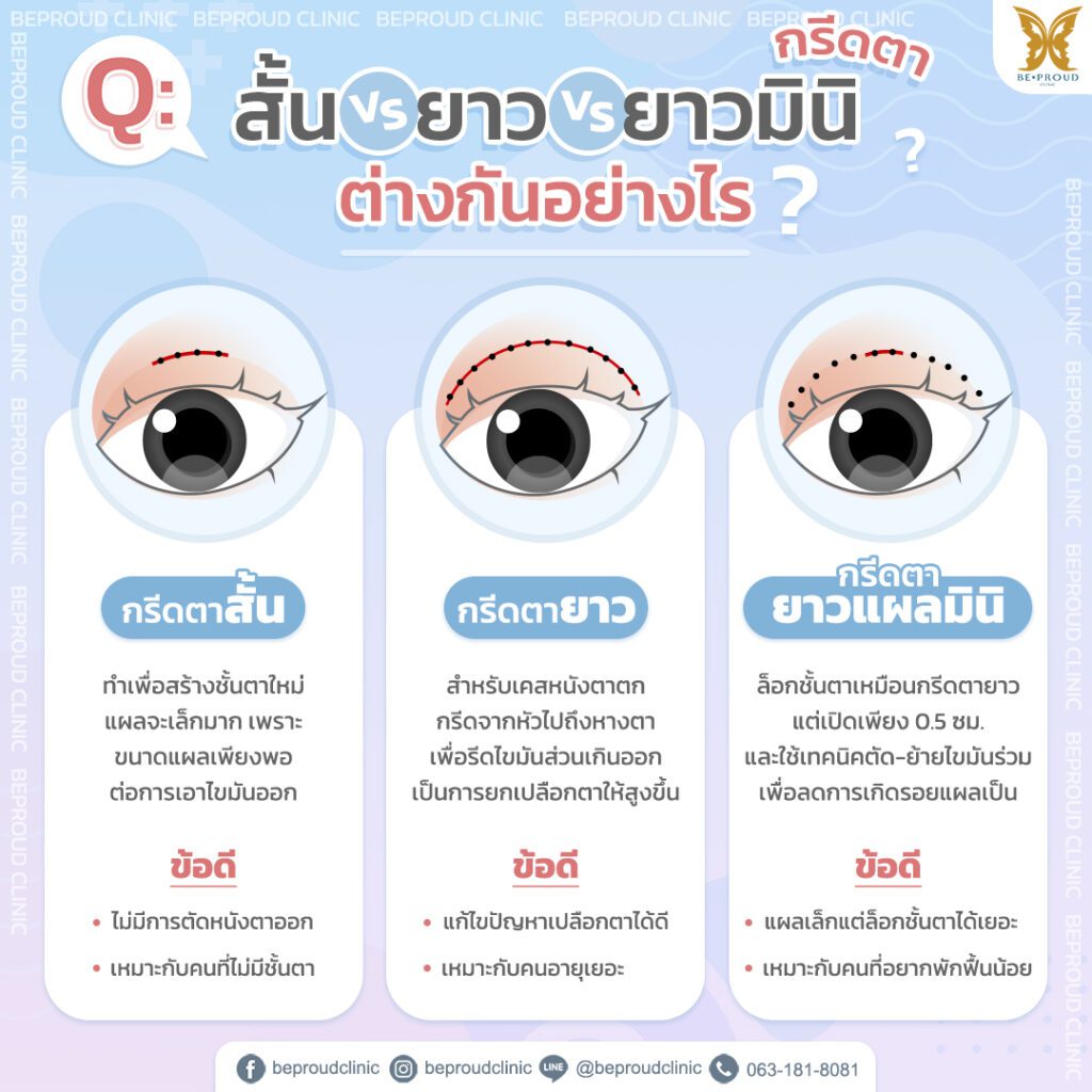ตาสองชั้น ตาสองชั้น