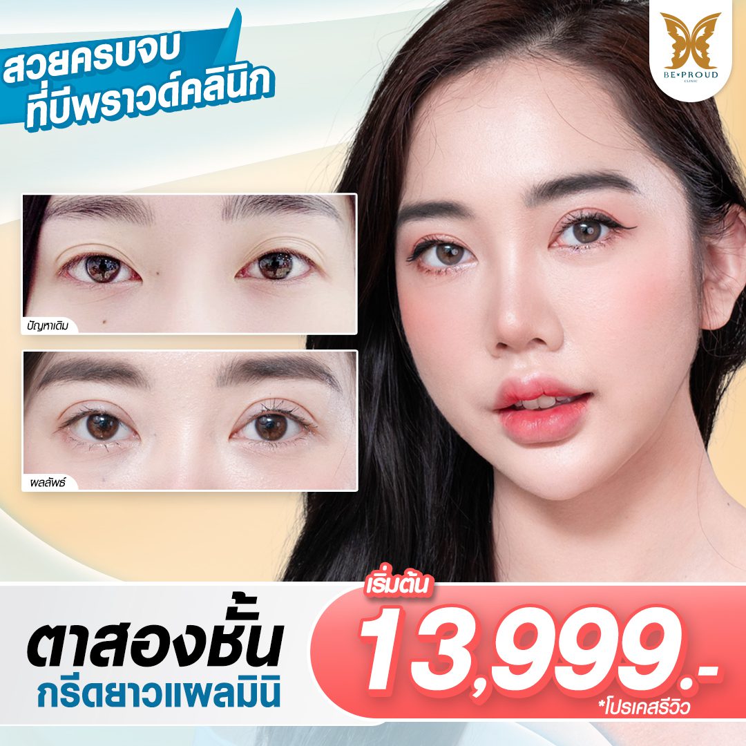 โปรโมชั่น_ตาสองชั้น โปรโมชั่น_ตาสองชั้น