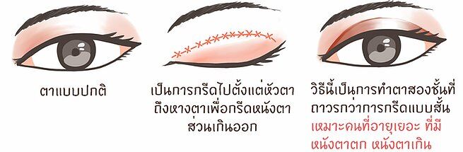 ตาสองชั้น