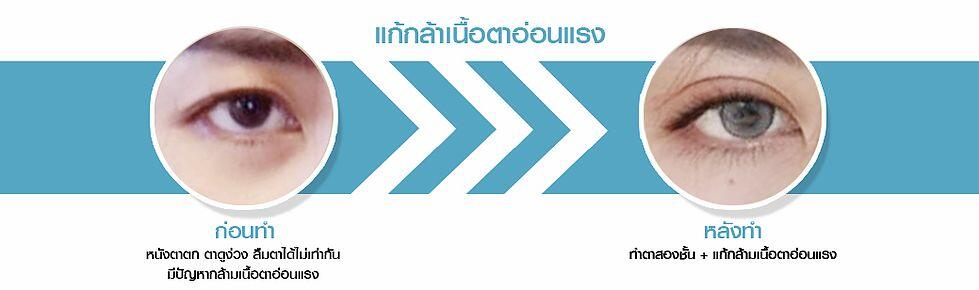 ตาสองชั้น
