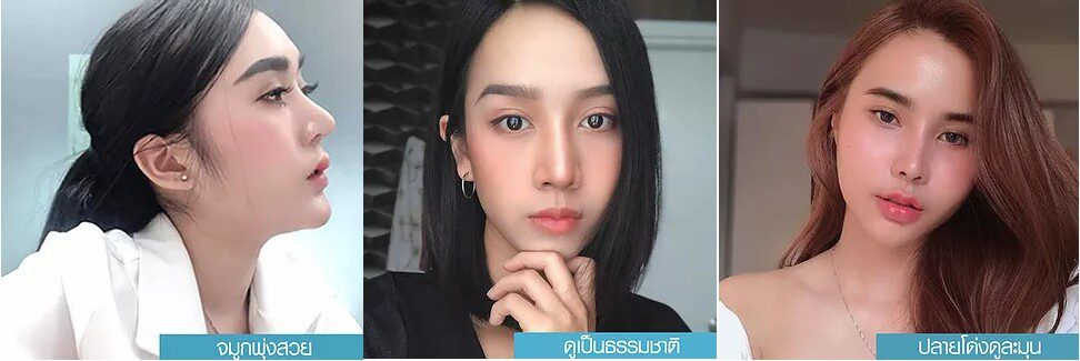 1607672758289 เสริมจมูก