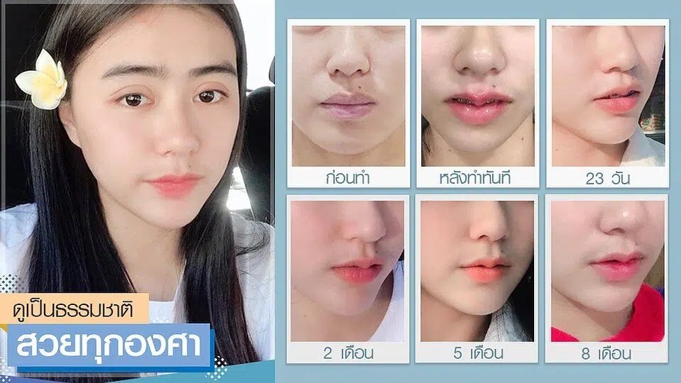 8างบีพราวด์