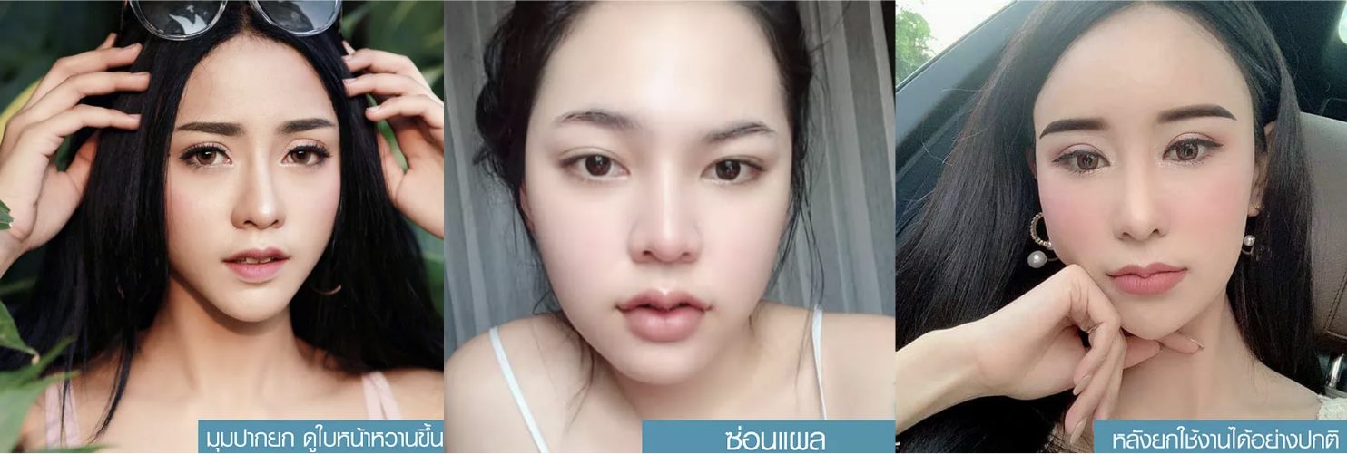 Screen Shot 2563-11-17 at 16.14.43 ปากกระจับ