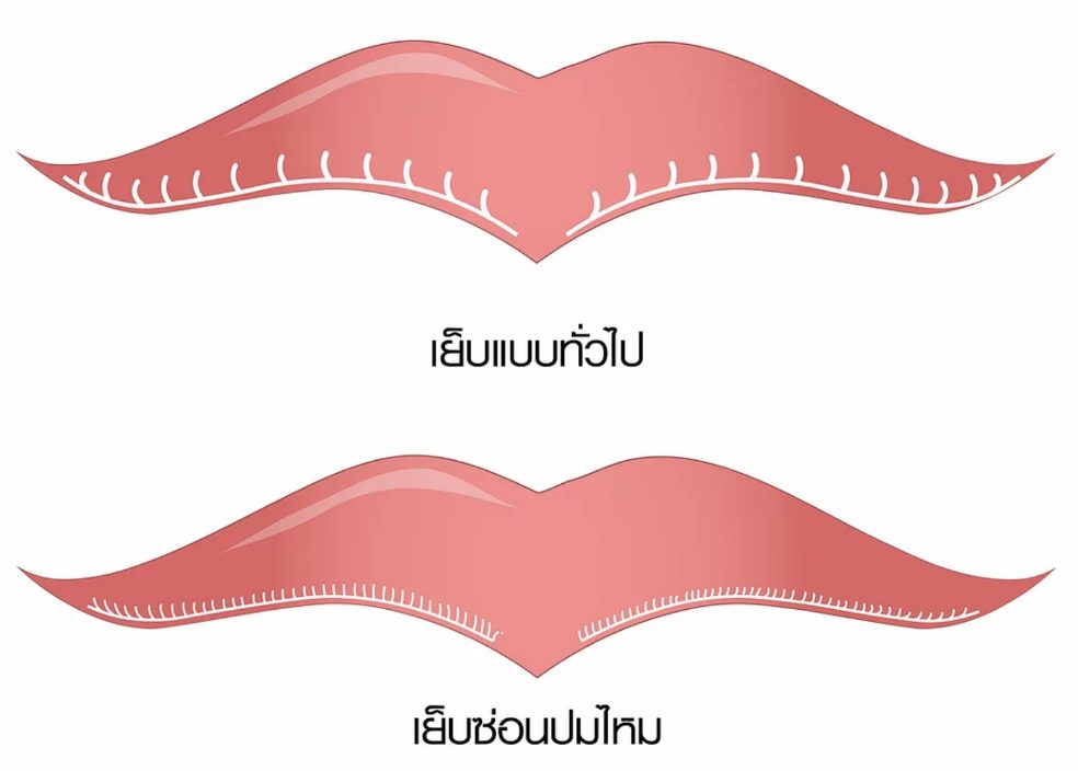 Screen Shot 2563-11-17 at 16.27.51 ปากกระจับ