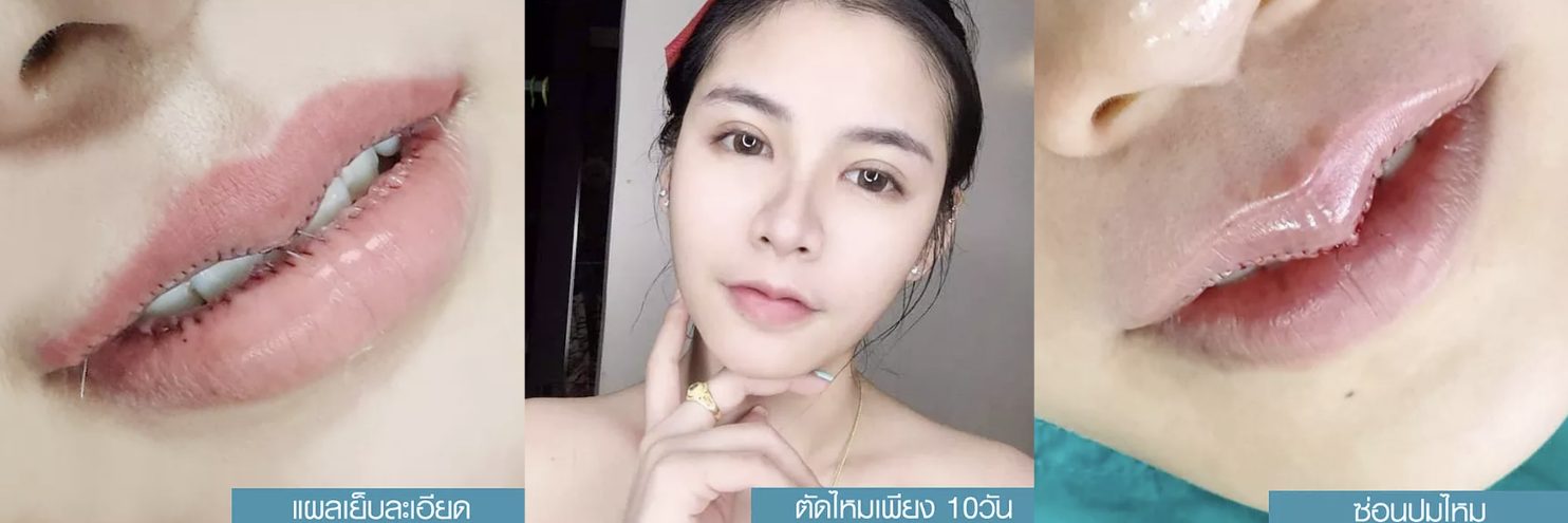 Screen Shot 2563-11-17 at 16.29.22 ปากกระจับ