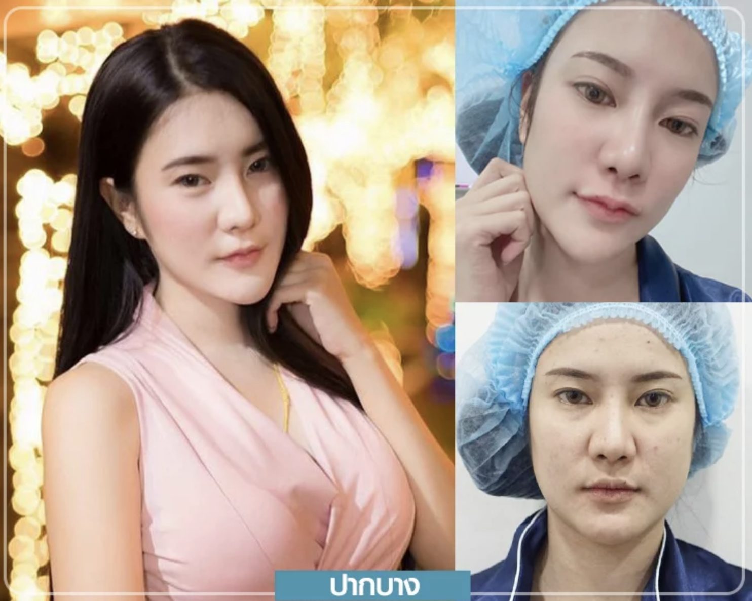 Screen Shot 2563-11-17 at 16.40.11 ปากกระจับ รีวิวปากกระจับ ปากกระจับปีกนางฟ้า
