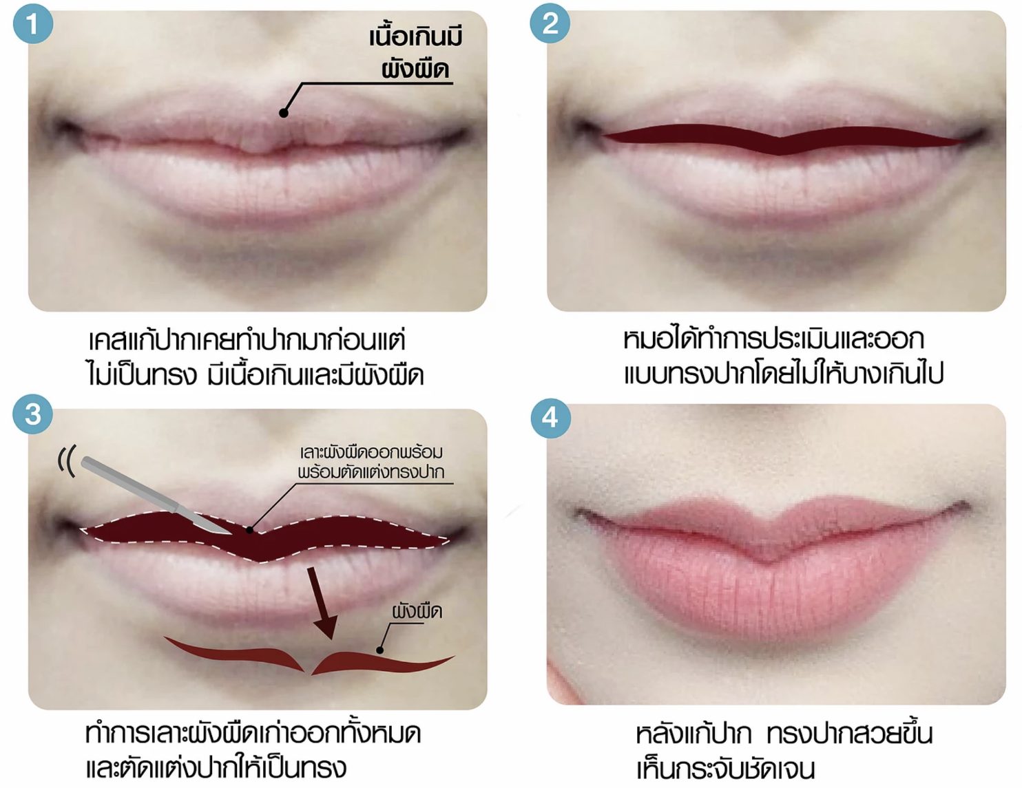 Screen Shot 2563-11-17 at 16.45.07 ปากกระจับ ดูแลปากกระจับ ทำปากกระจับ