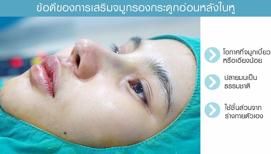 เสริมจมูก