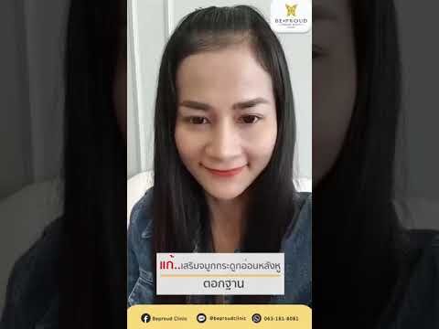 เสริมจมูก