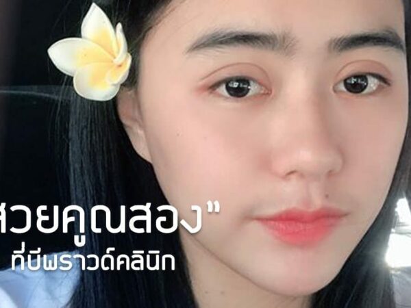 รีวิวทำปากคาง