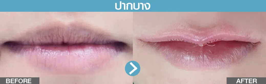 รีวิวปากกระจับ ปางบาง