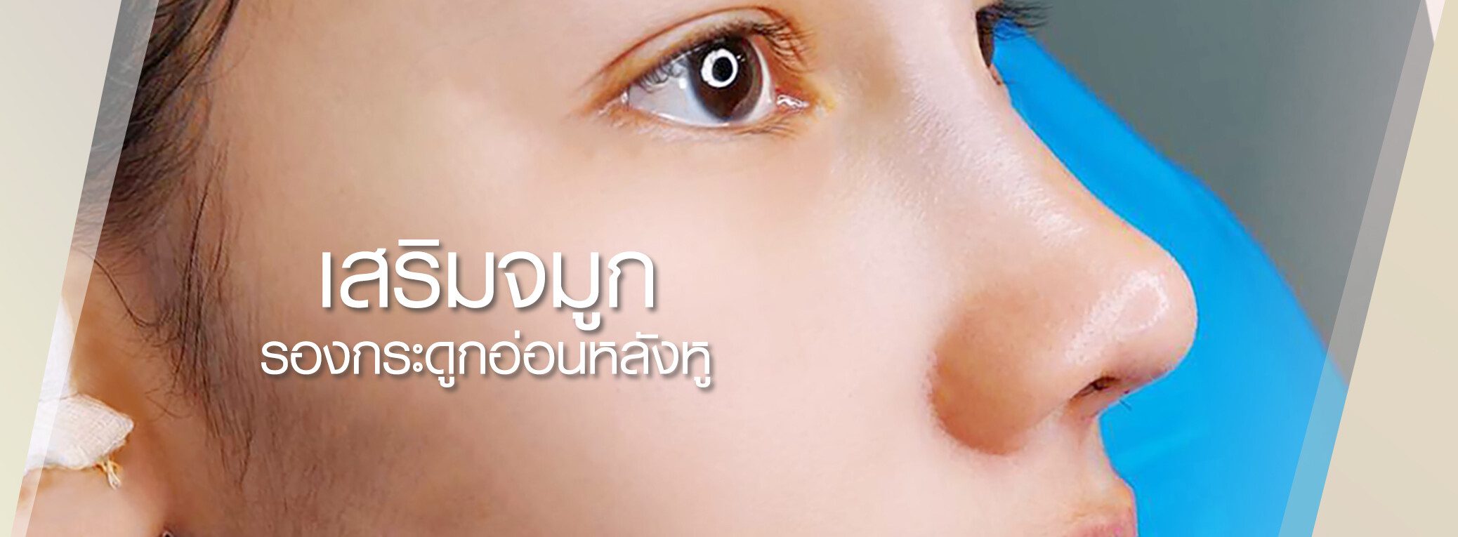 เสริมจมูก