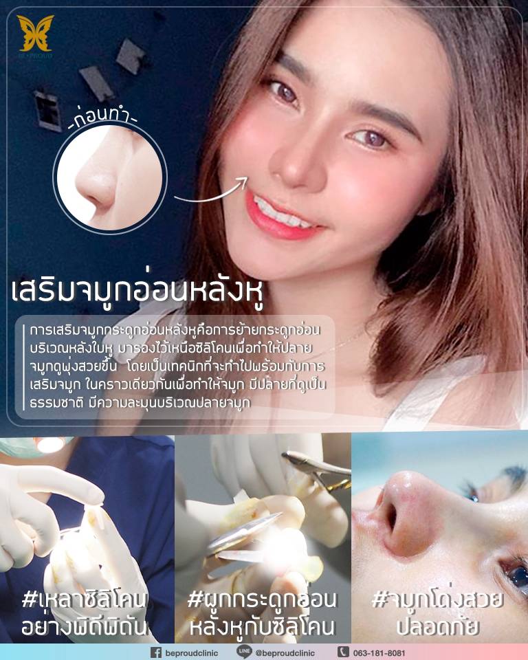 1000312 จมูกติดเชื้อ เสริมจมูก หลังทำศัลยกรรมเสริมจมูก