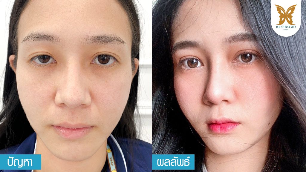 ปัญหาผลลัพธ์ ปัญหาผลลัพธ์