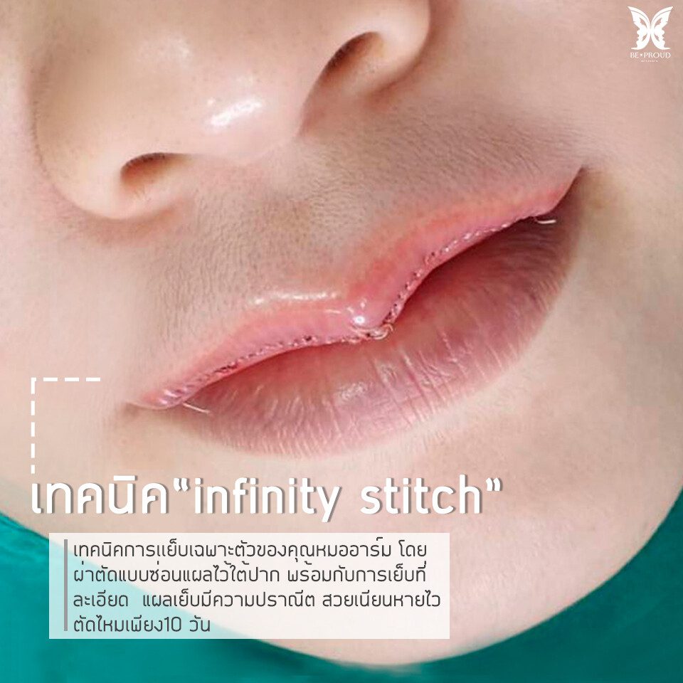 เรื่องควรรู้ก่อนทำปากกระจับ2 infinity stitch เรื่องควรรู้ก่อนทำปากกระจับ2 infinity stitch