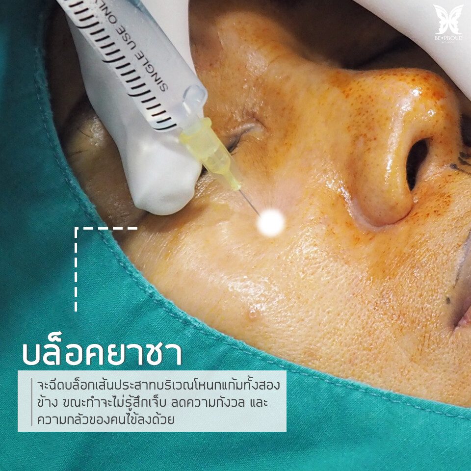 เรื่องควรรู้ก่อนทำปากกระจับ2 บล็อคยาชา เรื่องควรรู้ก่อนทำปากกระจับ2 บล็อคยาชา