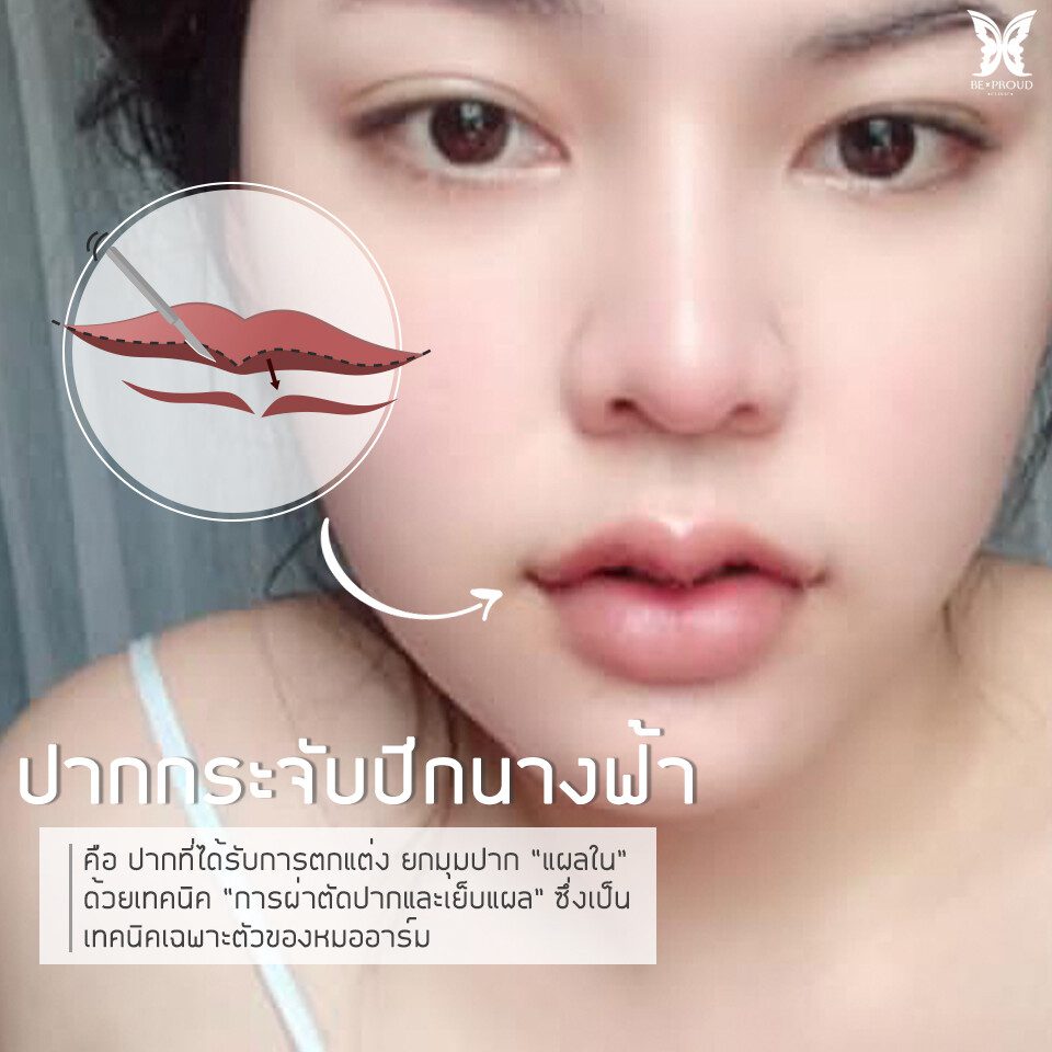เรื่องควรรู้ก่อนทำปากกระจับ2 ปากกระจับปีกนางฟ้า