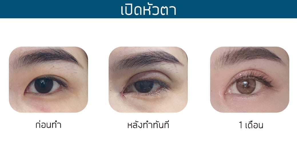 เปิดหัวตา เปิดหัวตา