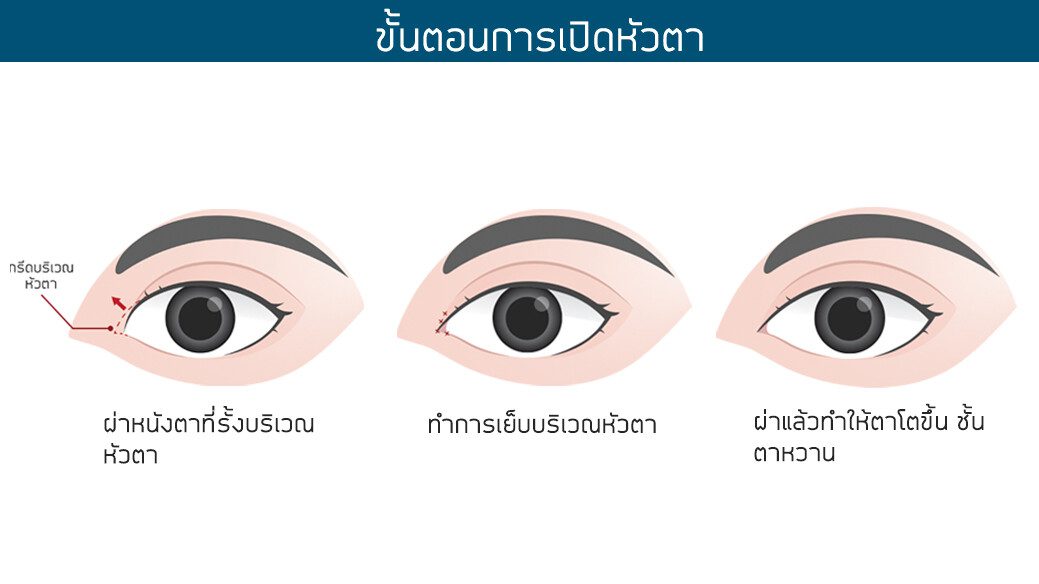 เปิดหัวตา เปิดหัวตา