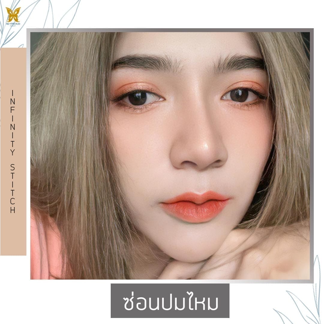 InfinityStitches1 ซ่อนปมไหม