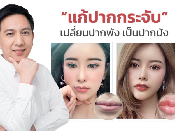 เคสแก้ ปากกระจับ