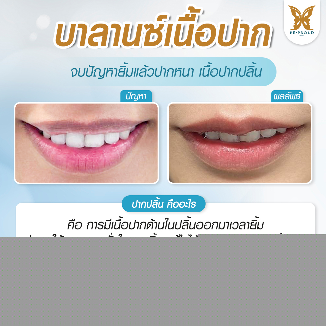 รีวิว ปากกระจับ