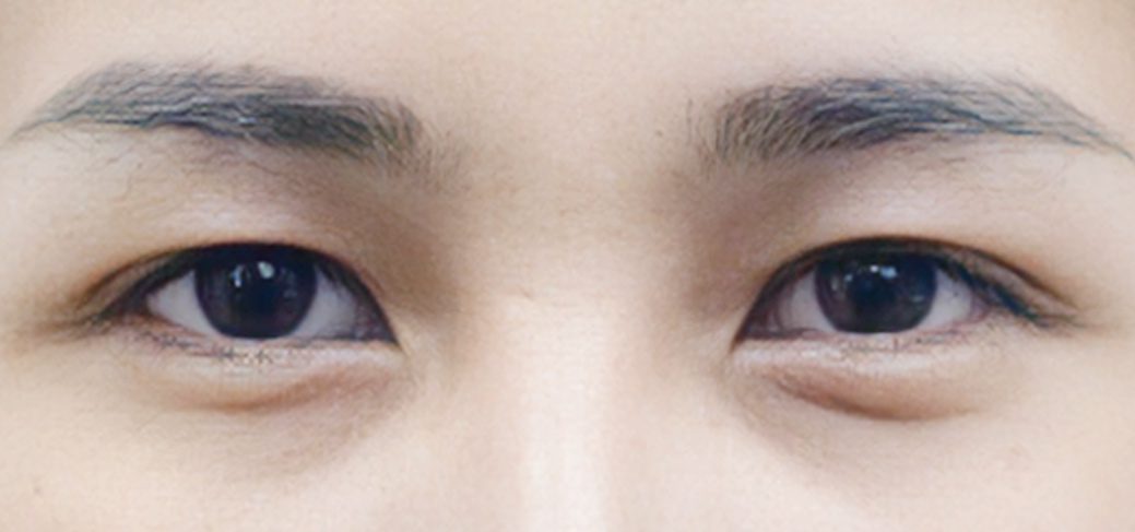 ชั้นตาตก2