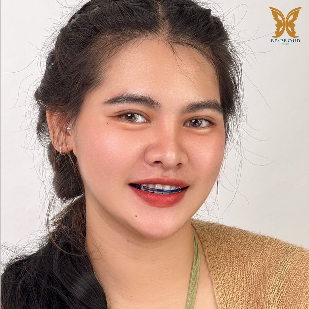 ตาสองขั้น_รีวิว ตาสองขั้น_รีวิว