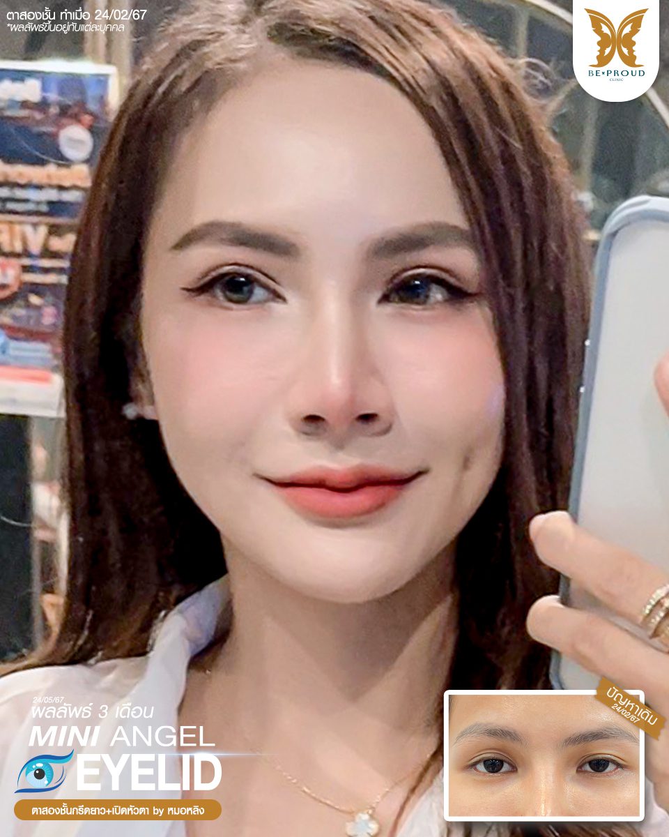 ตาสองขั้น_รีวิว