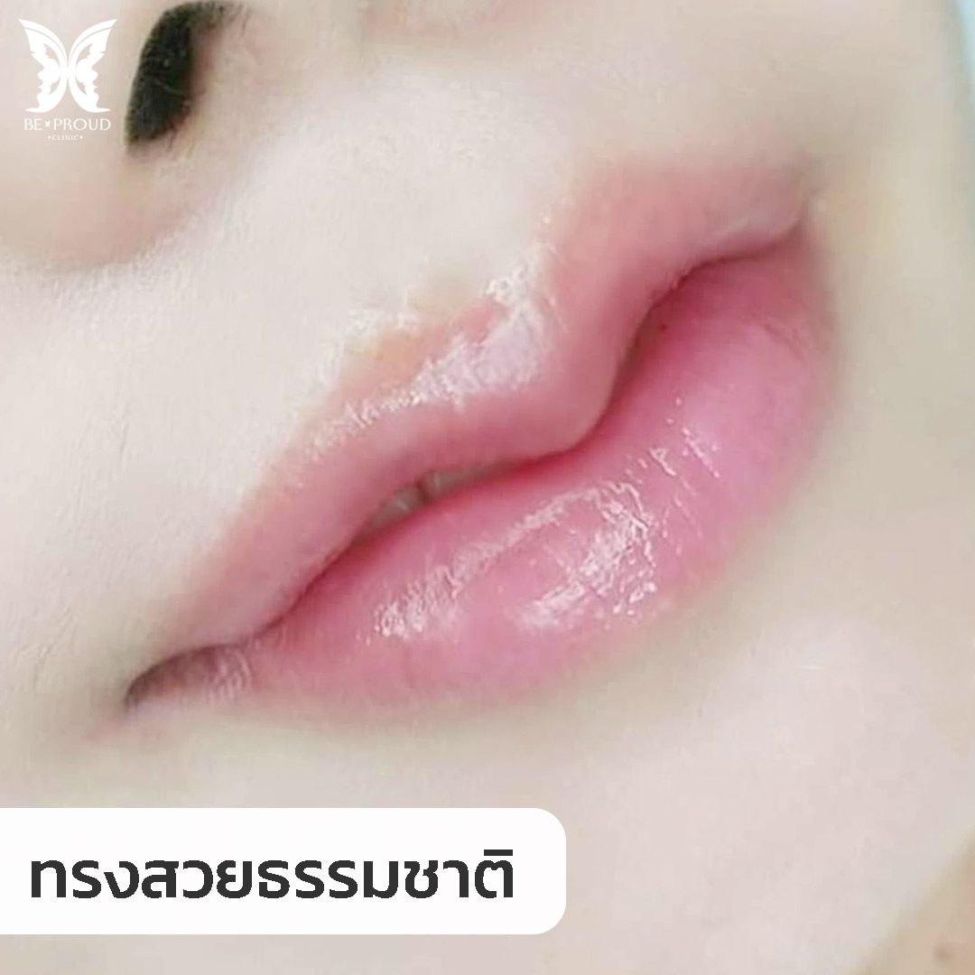 ทรงสวย ทรงสวย