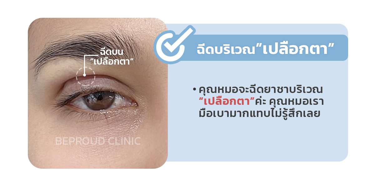 ทำตาฉีดยาชาตรงไหน