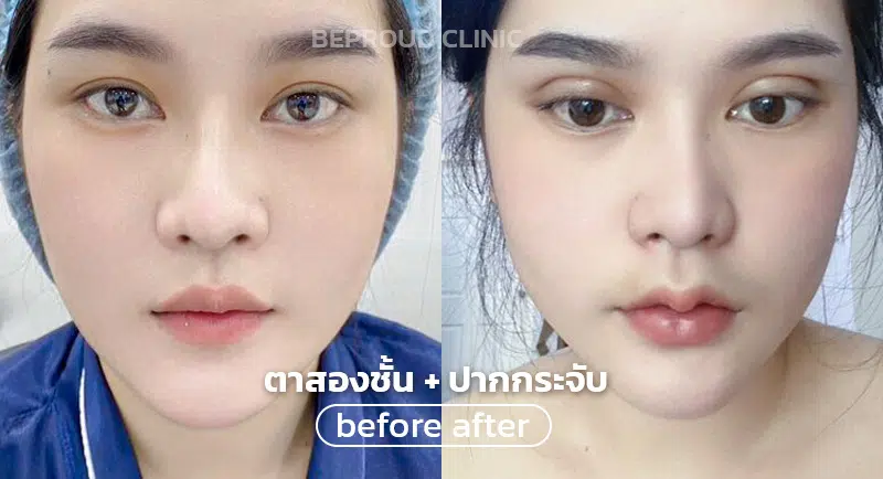 ทำตากับปาก