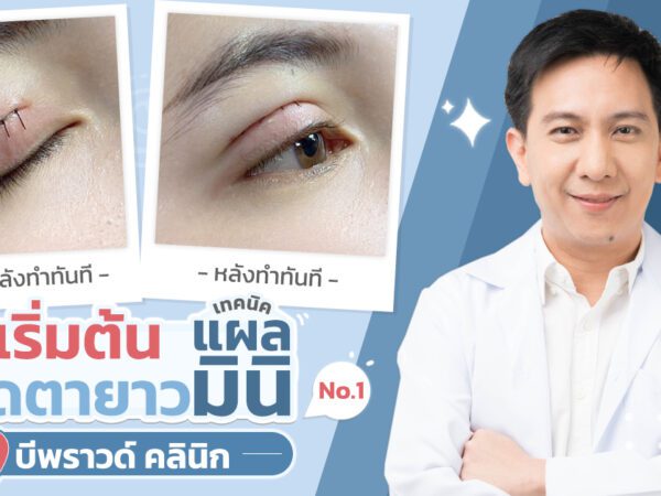 ปก_ทำตาสองชั้น กรีดยาวแผลมินิ