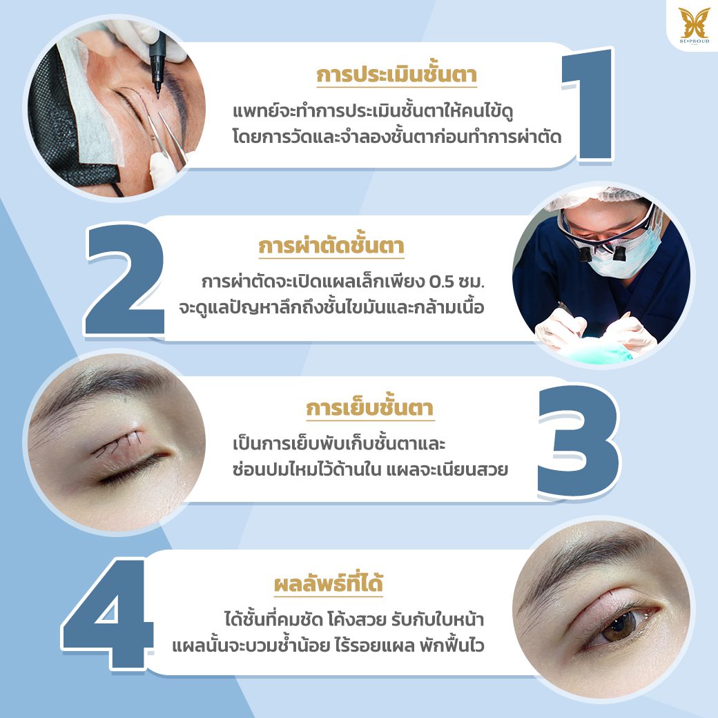 สายฝอvsสายเกา_ขั้นตอนการทำตาสองชั้น ขั้นตอนการทำตาสองชั้น