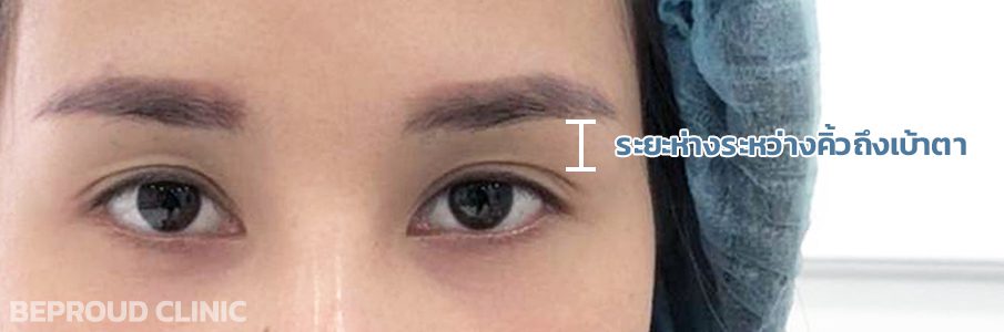 สายฝอvsสายเกา_ระยะห่างของเบ้าตา ระยะห่างของเบ้าตา