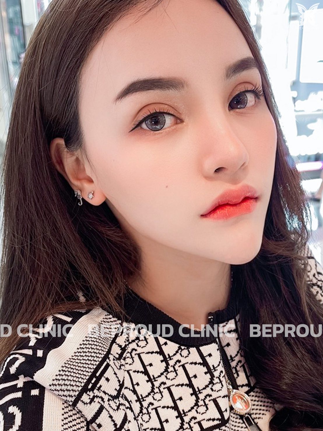 สายฝอvsสายเกา_สายฝอ-3 ตัวอย่างสายฝรั่ง-3