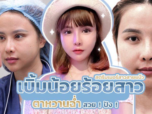 ตาสองชั้นกรีดยาวแผลมินิ_เบิ้มน้องร้อยสาว