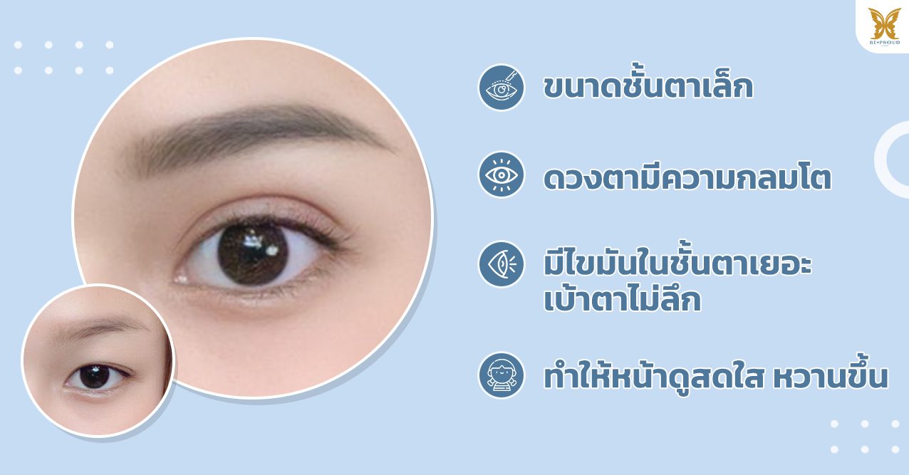 ลักษณะตาสองชั้นสายเกาหลี_เกาหลี ลักษณะตาสองชั้นสายเกาหลี_เกาหลี