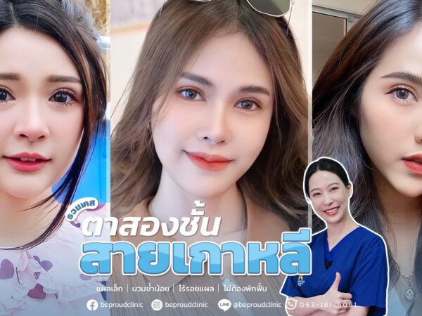 ตาสองชั้น_ตาสองชั้นสายเกาหลี_หมอหลิง