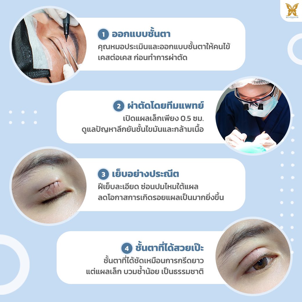 ขั้นตอน ขั้นตอน_ทำตาสองชั้น