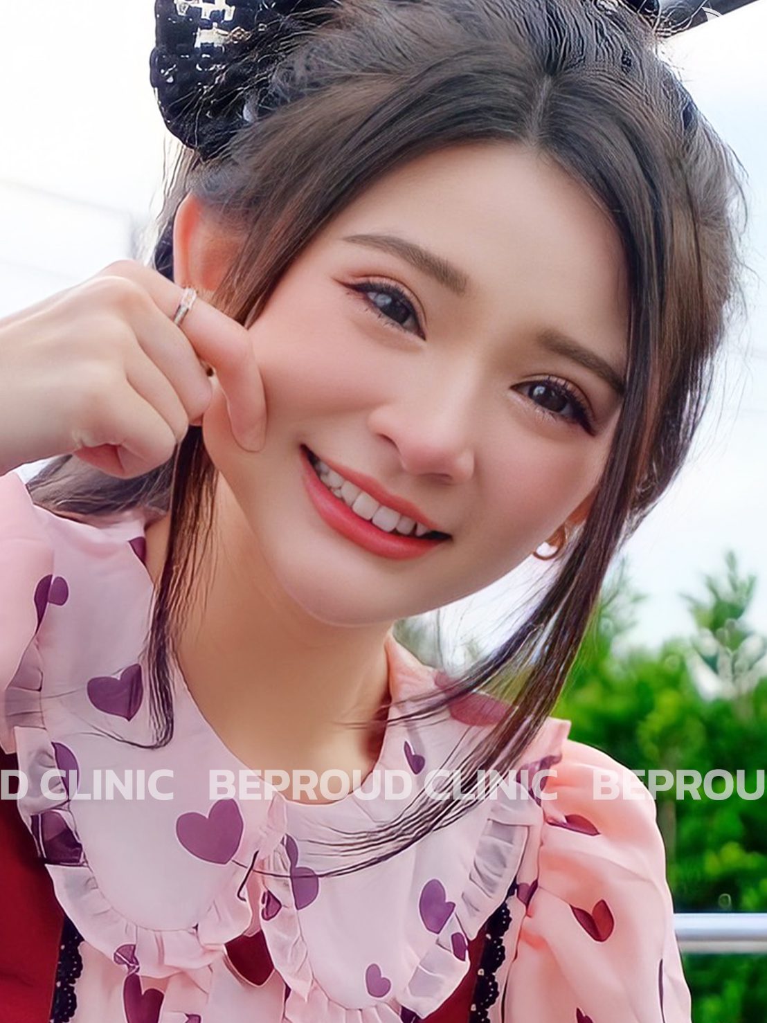สายเกาหลี-1 ตาสองชั้น_สายเกาหลี